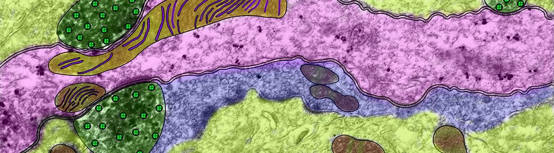 A long pink patch surrounded by purple, then green, with potato-like brown patches