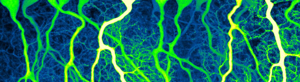 Scientific image of several cells resembling floating balloons with strings attached