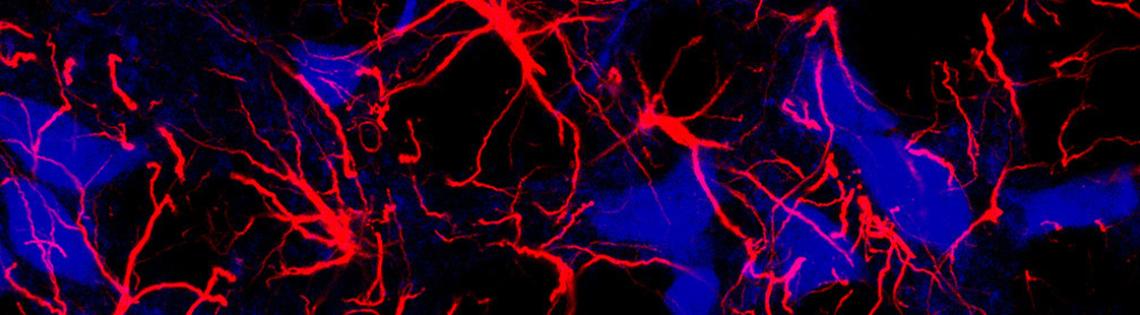 Microscopic image of star-shaped brain cells, called astrocytes (red)