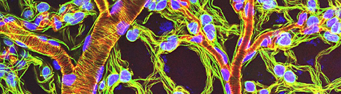Breathing tubes embedded in the weblike sheath cells that cover developing egg chambers in a lubber grasshopper