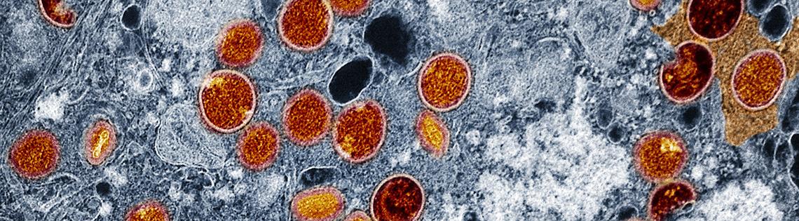 Colorized transmission electron micrograph of mpox virus particles (red and yellow) found within infected VERO E6 cells (blue).