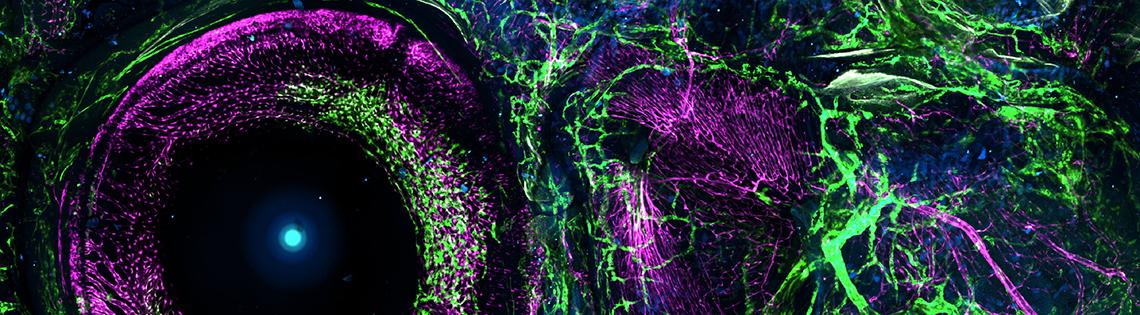 Green branches around a large purple circle: the blood vessels are in purple; the lymph vessels are in green.