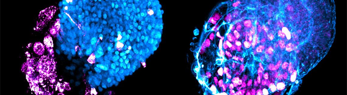 Scientific image featuring two groups of tiny blue bubbles shaped into ovals with small pink globes encroaching on parts of the ovals