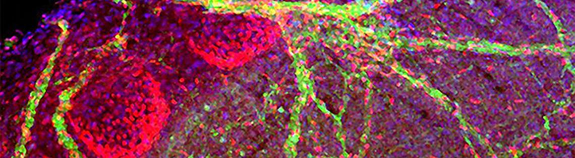 A microscopic image of a mouse's trachea