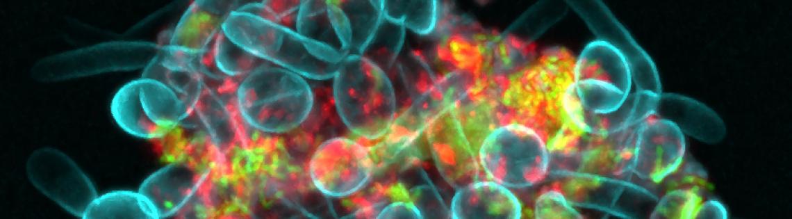 Microscope image of a group of microbes clumped together, labeled in red, blue, yellow, and green