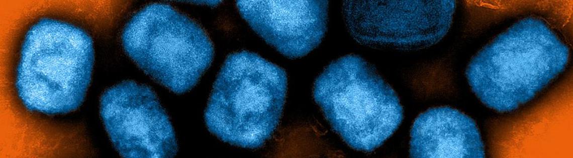 Blue cylindrical mpox virus particles cluster together on an orange background.