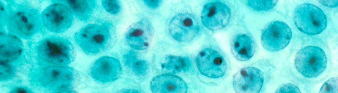 Microscopic human stomach cells stained light blue