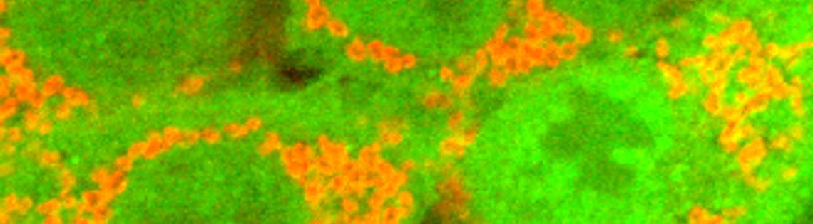 RNAi to find genes that interact with parkin (green), a protein that tags damaged mitochondria (red)