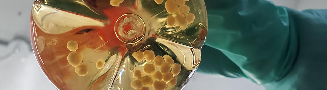 A researcher holds a flask containing human cerebral organoids.