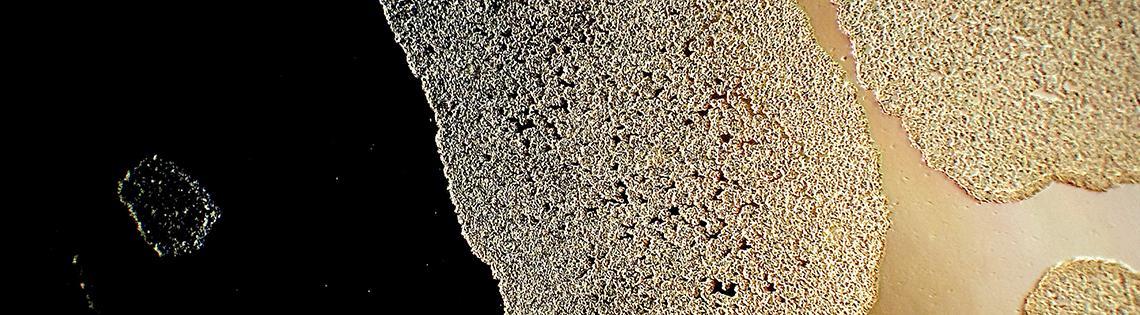 iPSC colonies captured using phase contrast microscopy