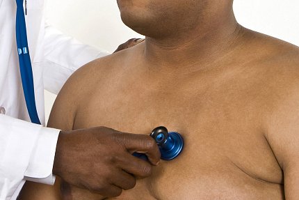 A doctor holds a stethoscope over the bare chest of an obese man.