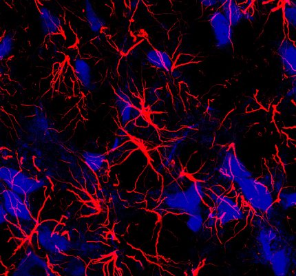 image of red star-shaped brain cells called astrocytes