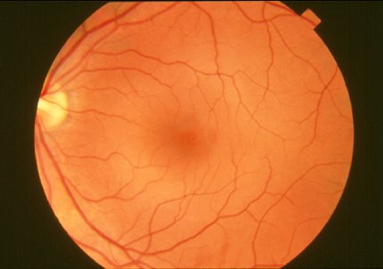 Closeup of a normal retina