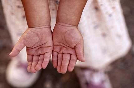 A baby's palms face up