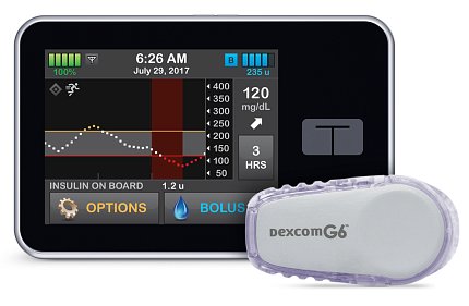 The Control-IQ artificial pancreas system device
