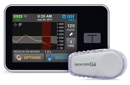 The Control-IQ artificial pancreas system device