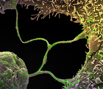 Scientific image showing Y-shaped chord connected at its ends to large yellow masses on a black background