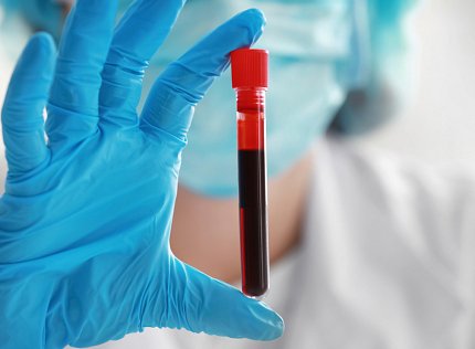 A scientist in blue surgical mask holds a vial full of blood with her blue-gloved hand.