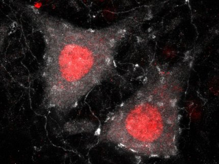 Two large red splotches against a black background surrounded by many white specks.