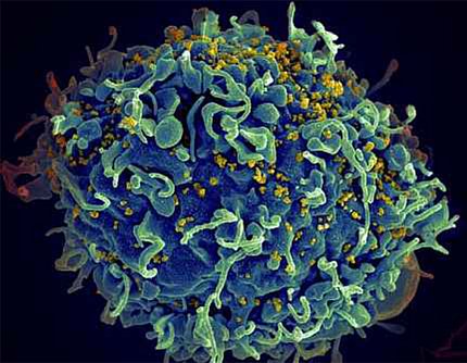 A flowery ball of dark and light blue strands with clusters of yellow dots