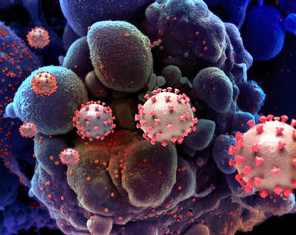 Rendition of SARS-COV-2 virus particles