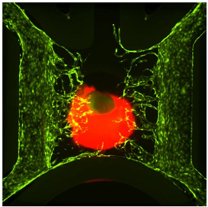 A bone organoid, shown as large red circle in middle, surrounded by green of tissue chip with black background