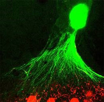 A green ball with branches extending out toward red (tissue)