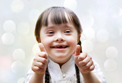 A young girl with Down syndrome smiling widely and holding two thumbs up