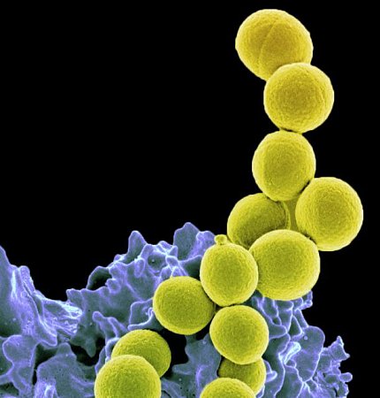 A microscopic image of MRSA