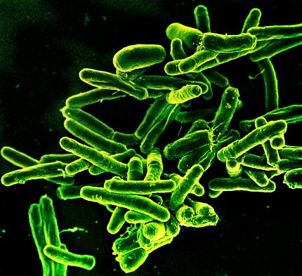 Scanning electron micrograph of Mycobacterium tuberculosis bacteria