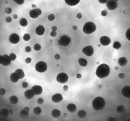 Microscopic image showing dark gray circles of varying sizes on a lighter gray background.