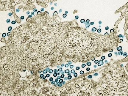 Transmission electron micrograph of HIV-1 virus particles (teal) budding and replicating from a segment of a chronically infected H9 cell (tan).