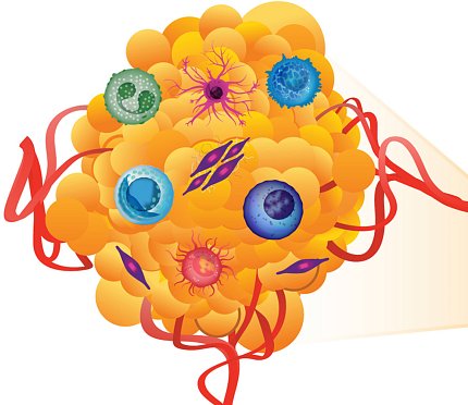 An illustration of a tumor cell
