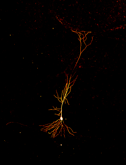 A golden-colored line with dendrites flaring out, against a black background