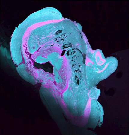 scientific image of blue blob shaped vaguely like Lincoln head's silhouette