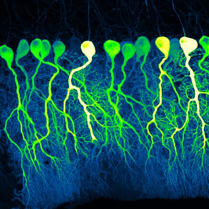 scientific image of brains cells resembling a line of green, yellow, and cream-colored balloons on strings floating in a black background