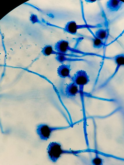 An image of blue-stained fungal spores under a microscope.