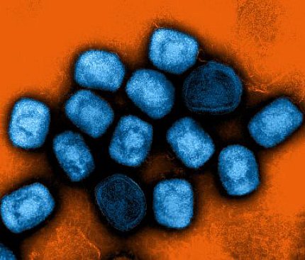 Mpox virus particles (oblong blue particles) on an orange background