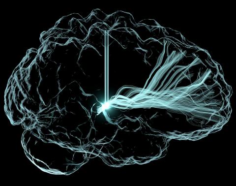 Light-based rendering of deep brain stimulation’s electrical excitation of neuronal fiber pathways to treat patients with traumatic brain injury