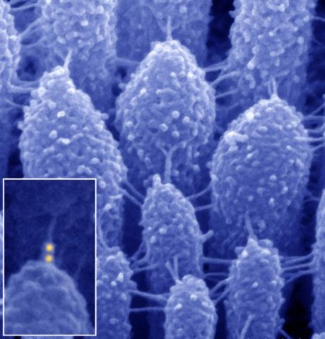 Scanning electron microscopy image illustrates tiny extracellular links between stereocilia of an inner ear hair cell