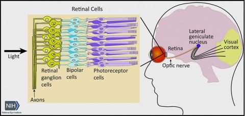 Diagram of the optic nerve shows light entering groups of retinal cells. An eye drawing shows location in head of retina, optic nerve and visual cortex.