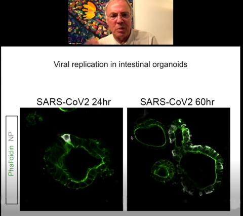 screenshot of green fluorescent stain 