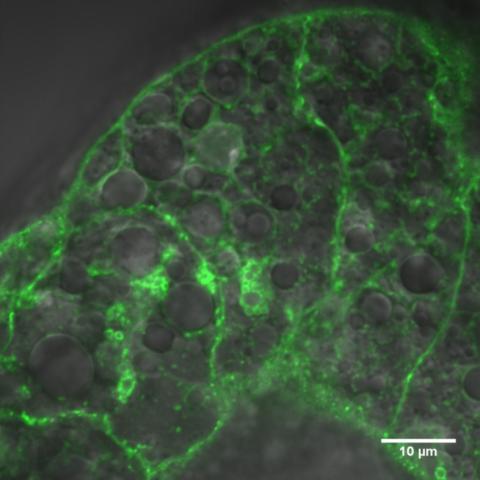 A microscopic image of fly fat.