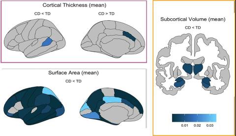 A chart featuring bi-sections of a brain