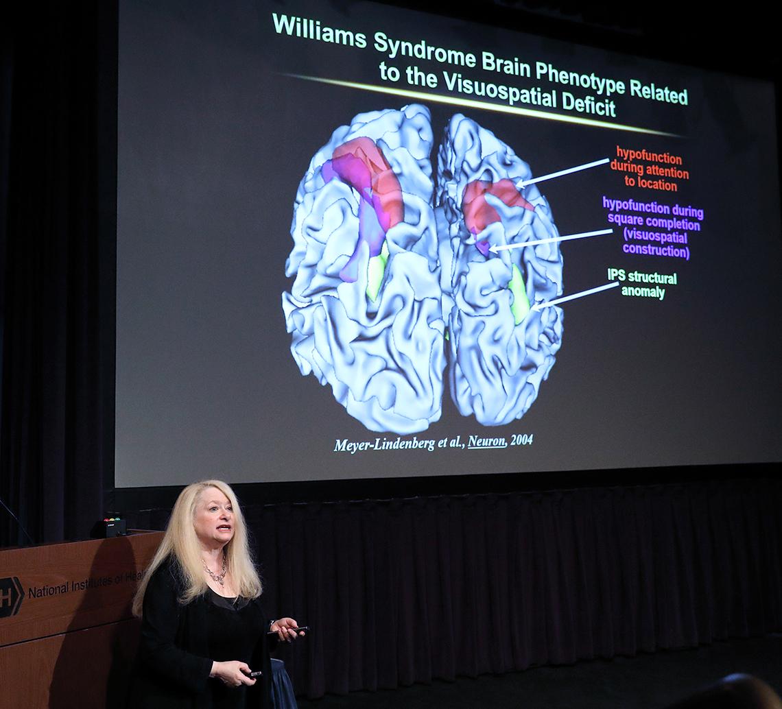 Berman speaks in front of slide featuring a brain scan