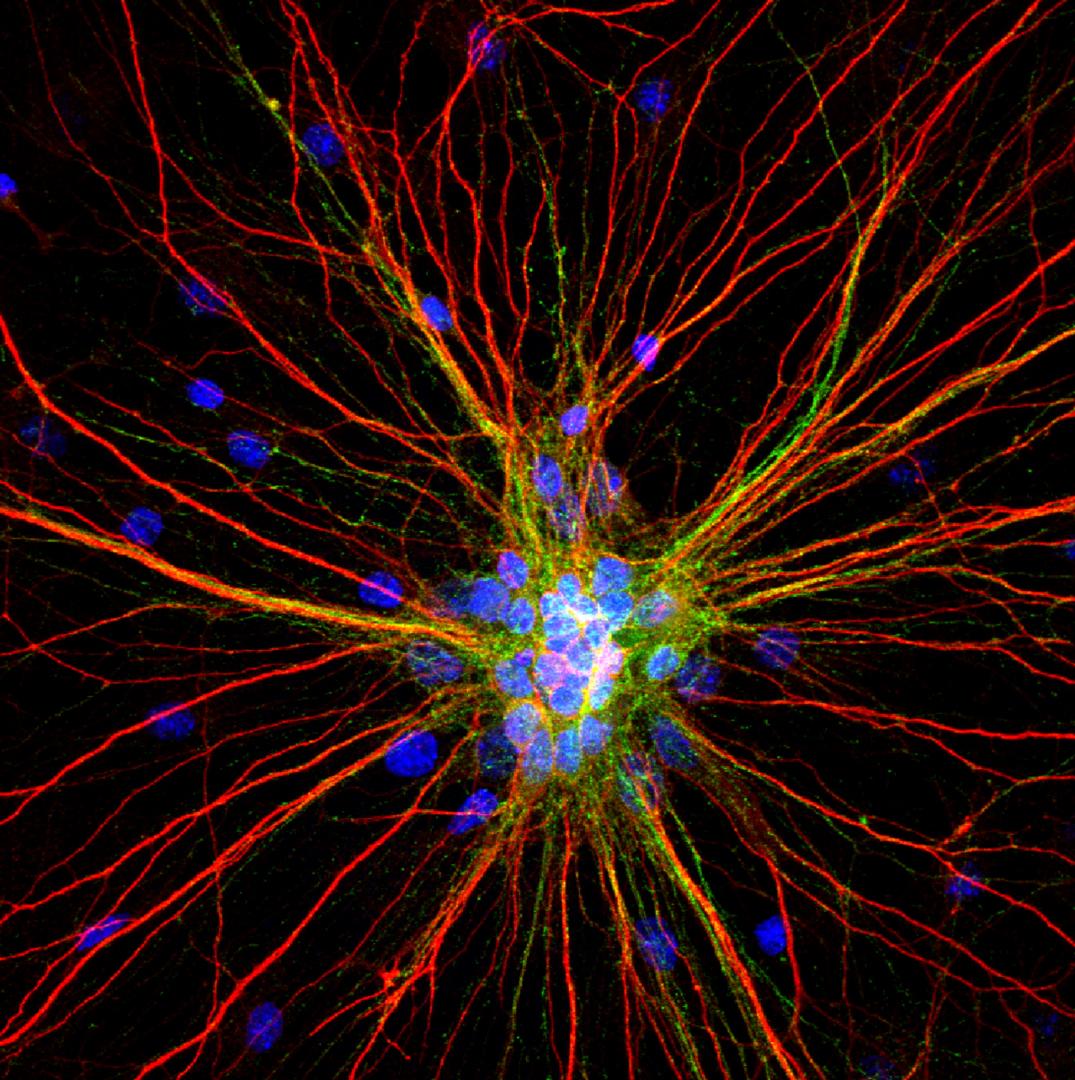 Rat cortical neurons labeled for dendrites (red), axons (green) and nuclei (blue).