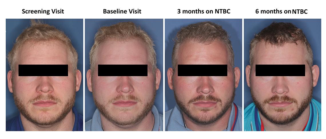 The illustration features four different photos of a man. The man has a paler complexion on the left. 