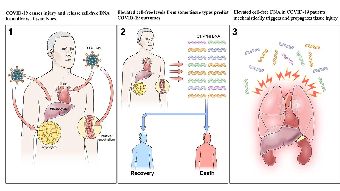 A graphic with 3 panels showing Covid viral particles entering and causing injury to the body; elevated cell-free DNA levels predicts Covid-19 outcomes.