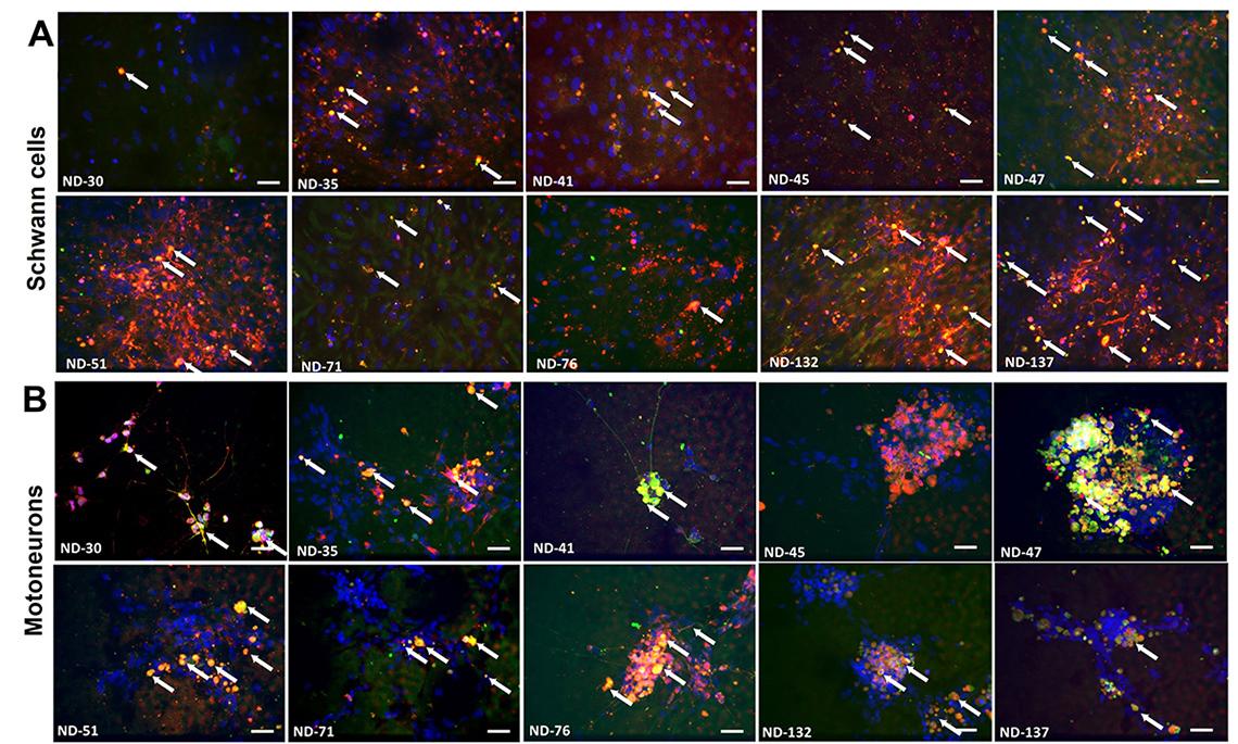 A 4X5 grid shows wisps of colors as antibodies attach to cells and motoneurons