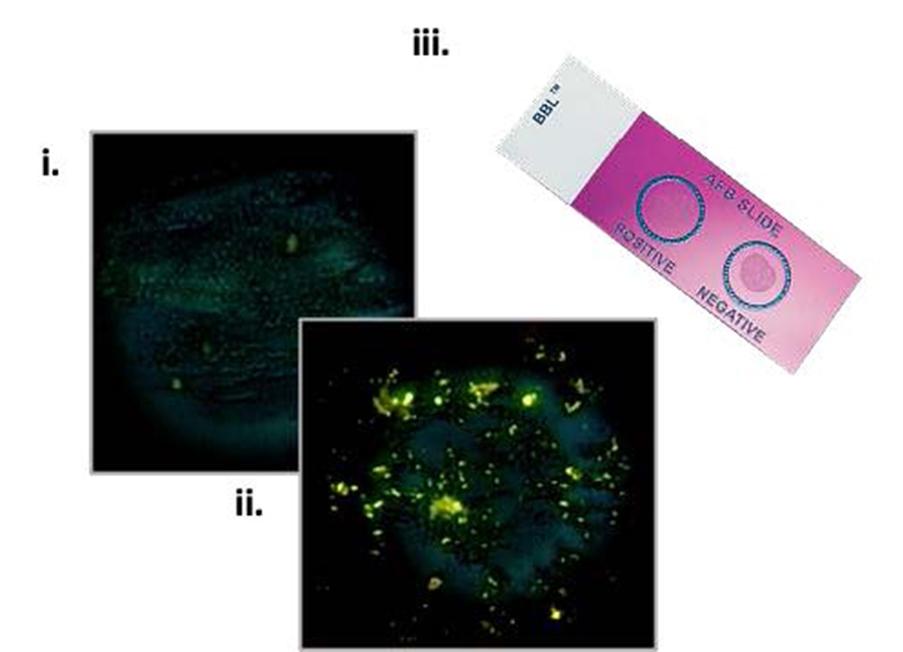 Two medical images and a diagnostic tool